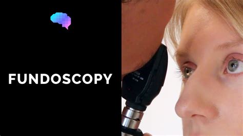 fundoscopy technique.